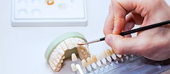 Chirurgiens-dentistes : pas d’accès partiel pour les prothésistes
