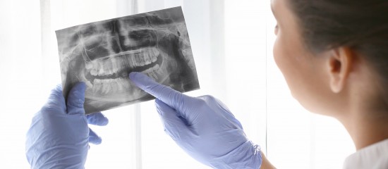 Dentistes : refonte de la réglementation en matière de radioprotection