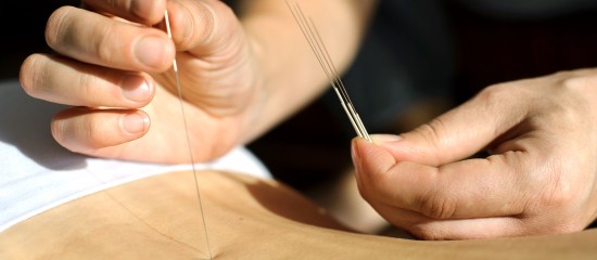 Acupuncteurs